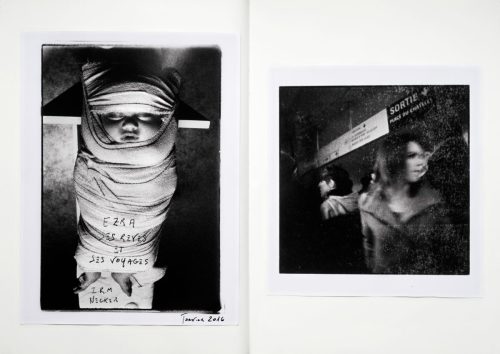 IRM de mon fils Ezra et scène dans le metro en janvier 2016.